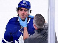Leafs’ Tavares hospitalized after scary hit to face